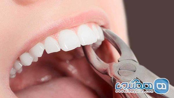دلایلی که می گویند باید دندانتان را بکشید