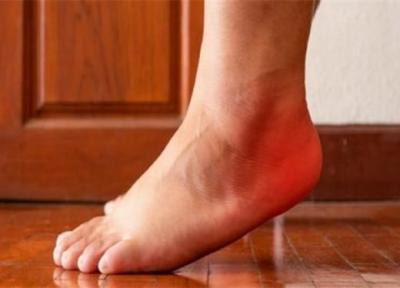 دلایل بروز درد در پاشنه پس از ورزش